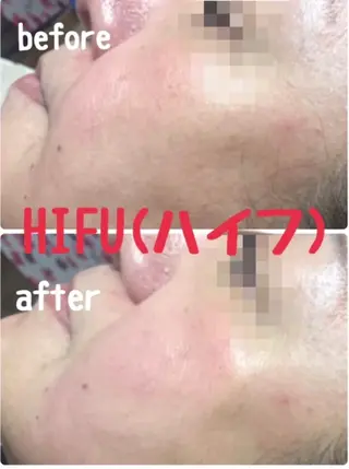 肌質改善サロン chouchouのエステ・リラクイメージ