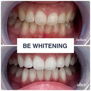 ホワイトニング専門店 ビーホワイト金山のその他イメージ