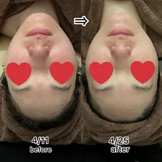 Folche博多 吉冨のエステ・リラクイメージ