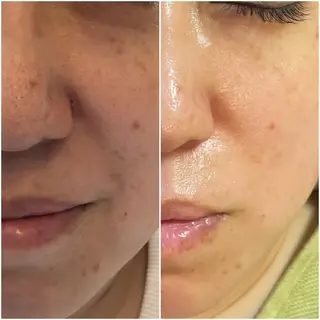 〚博多〛フィユ 水江のマツエク・マツパデザイン