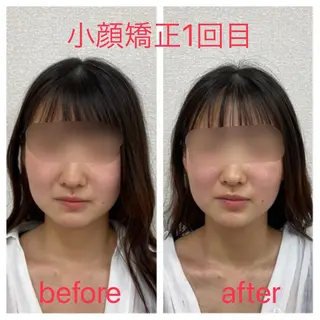 小顔矯正サロン Lilyのエステ・リラクイメージ