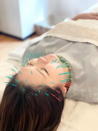 鍼灸サロン TIARA　美容鍼のエステ・リラクイメージ