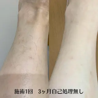 DUPE&MORE 店長kanaeのエステ・リラクイメージ