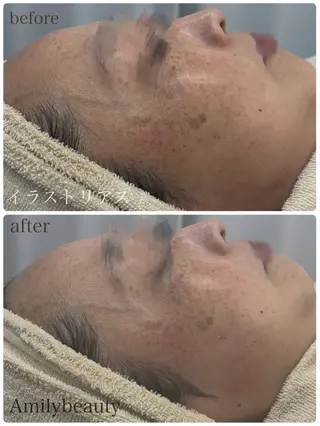 Amily beauty 毛利のエステ・リラクイメージ