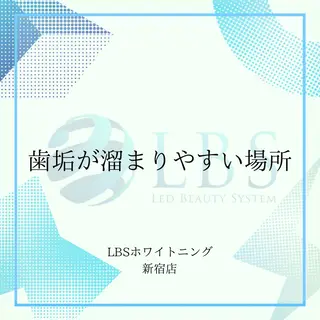 LBSホワイトニング 新宿店💎公式のエステ・リラクイメージ