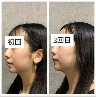 肌質改善専門 ハーブ /毛穴洗浄 リエイトのエステ・リラクイメージ