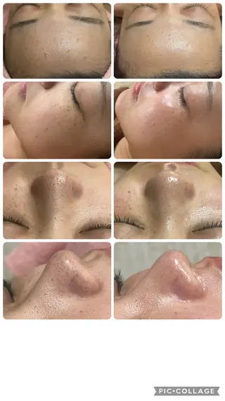 フェイシャル/脱毛 ジョアアンジェ竹田のエステ・リラクイメージ