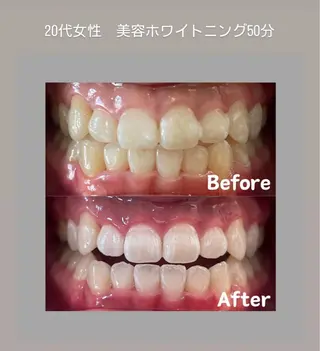 Kaula ホワイトニング🦷✨のエステ・リラクイメージ