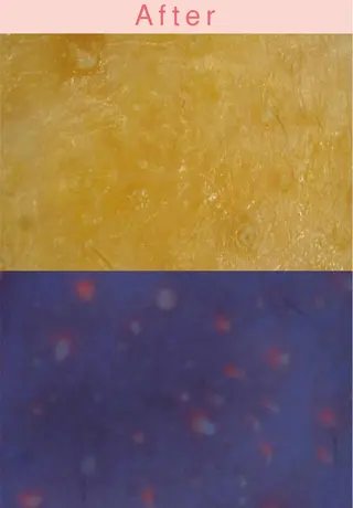 ポアレスサロン フィルのエステ・リラクイメージ