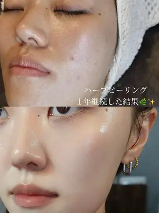 艶肌デトックス🫧 Samiraのエステ・リラクイメージ