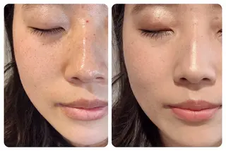 ナリス化粧品 Yumenaのエステ・リラクイメージ