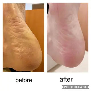 ケセラ ネイルケアのエステ・リラクイメージ