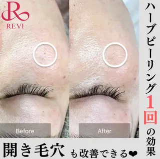 beauty salonWのエステ・リラクイメージ