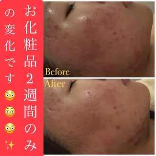 ショート カラー パーマ ヘアアレンジ メンズ キッズ ネイル マツエク・マツパ ニキビ・肌質改善専門 ♡人生が変わるサロンのエステ・リラクイメージ