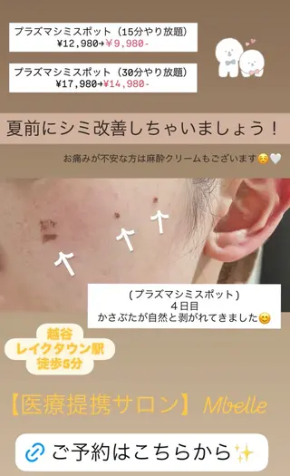 【医療提携サロン】Mbelle所属・肌質改善Mbelle 越谷レイクタウン🌿のエステ・リラクイメージ