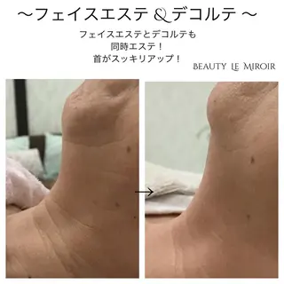 ビューティー ミロワールのエステ・リラクイメージ