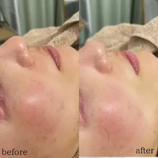 八木 浩子のエステ・リラクイメージ