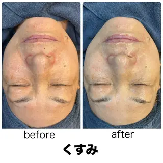 leolo武蔵浦和 肌質改善＆脱毛のエステ・リラクイメージ