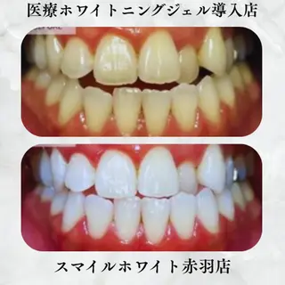 ネイル スマイルホワイト 赤羽店のエステ・リラクイメージ