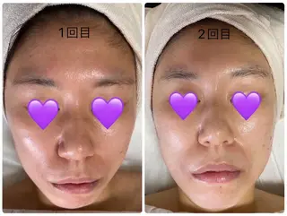 COCO beautyサロンのエステ・リラクイメージ