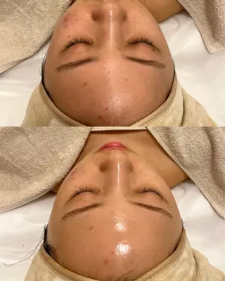 mumu 野々市若松店所属・mumu Rちゃんのエステ・リラクイメージ