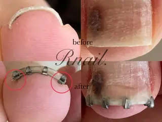 ネイル R nail.のネイルデザイン