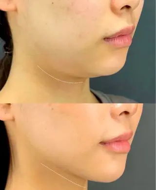 愛維美水光美肌専門店所属・愛維美水光美肌専門店 メンズレディースokのエステ・リラクイメージ