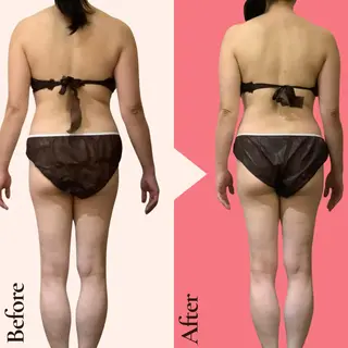 痩身ダイエット専門店 プレシャスのエステ・リラクイメージ