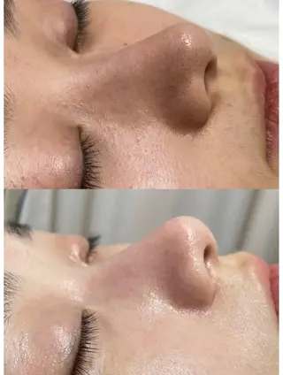 THEONE 山本のエステ・リラクイメージ