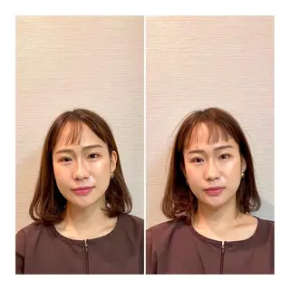 即小顔♥️美容鍼× ハーブピーリングのその他イメージ