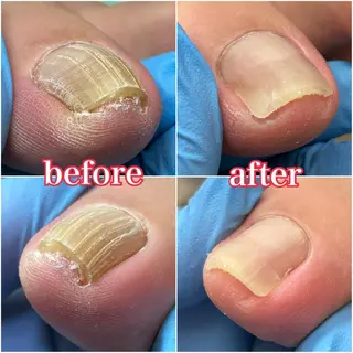 ネイル 巻き爪補正店　柏店所属・巻き爪補正店 柏店のその他イメージ