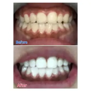 Ｍ渋谷 ホワイトニングのエステ・リラクイメージ