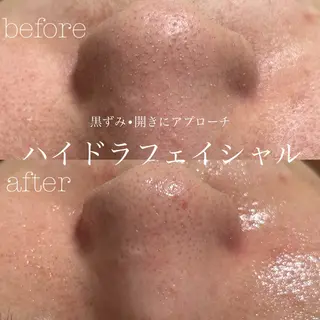 フェイシャルサロン CHIARA 荒田のエステ・リラクイメージ