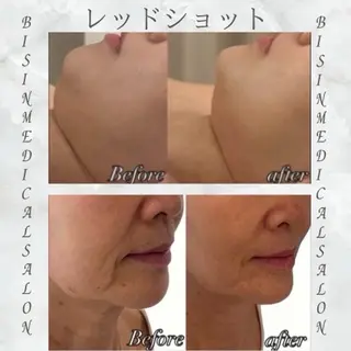 BISIN MEDICAL salon所属・BISIN MEDICALのエステ・リラクイメージ