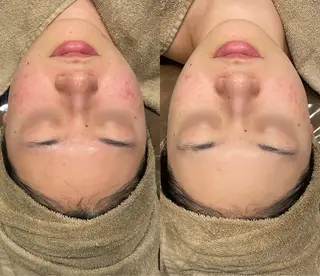 Re:Belle 久留米 : 中島のエステ・リラクイメージ