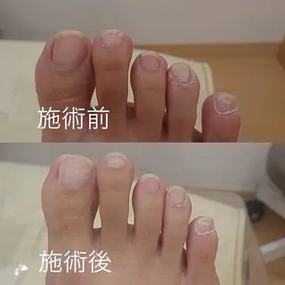 ケセラ ネイルケアのエステ・リラクイメージ