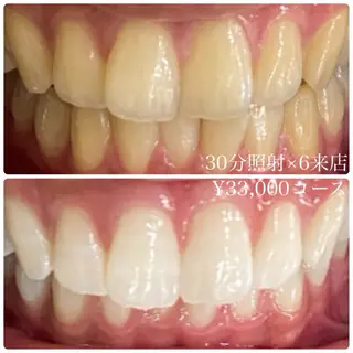 ホワイトニングルーム 横浜店のその他イメージ