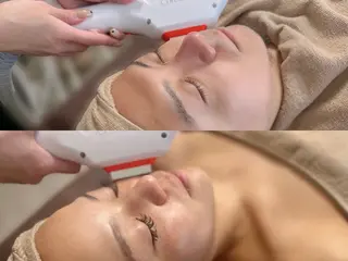 メンズ 脱毛/韓国肌管理 Epina 横浜店のその他イメージ