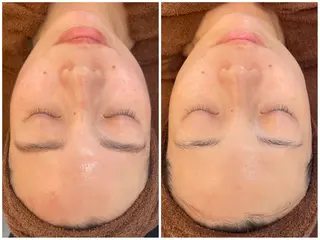 パーソナルスキンケア 🦋APRI🅿️有のエステ・リラクイメージ