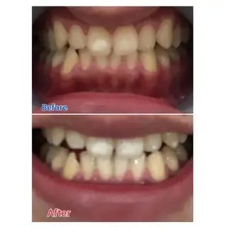 M渋谷 ホワイトニングのエステ・リラクイメージ