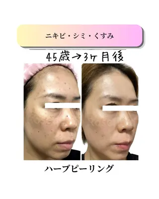 ローズフィールド 森岡朋美のエステ・リラクイメージ