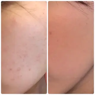 自由が丘📍 Belrougeのエステ・リラクイメージ