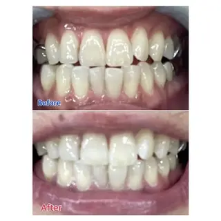 M渋谷 ホワイトニングのエステ・リラクイメージ