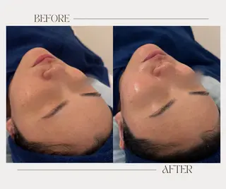 艶肌ワックス ALLY.のエステ・リラクイメージ