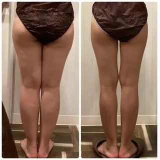 痩身脱毛専門店 Partirのエステ・リラクイメージ