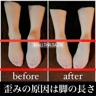 🌈歪み改善🌈 バリンタイ すぎうらのエステ・リラクイメージ