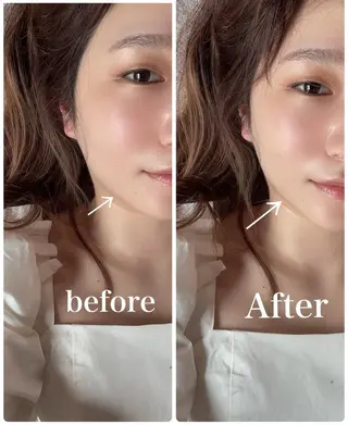 鍼灸 Refineのその他イメージ