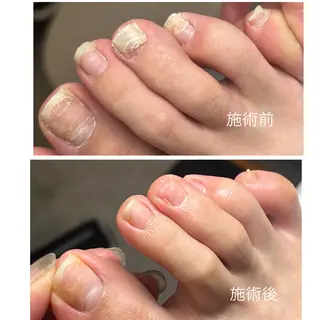 ネイル KIKOA NAIL キコアネイルのネイルデザイン
