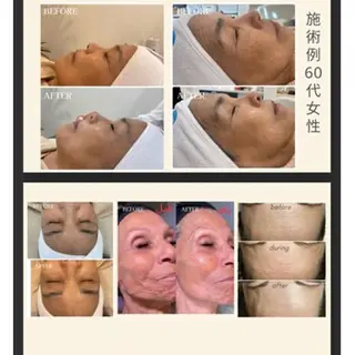 艶肌ワックス ALLY.のエステ・リラクイメージ