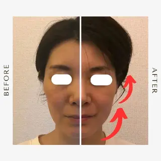 美容鍼×エステ 鍼灸 サロンmiyabiのエステ・リラクイメージ